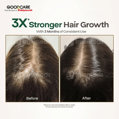 Goodcare Root Boost Hibiscus & Bhringhraj Hair Oil 100ml
